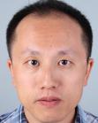 Before Hair Transplant &nbsp;Front